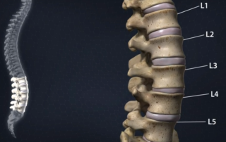 Spine care